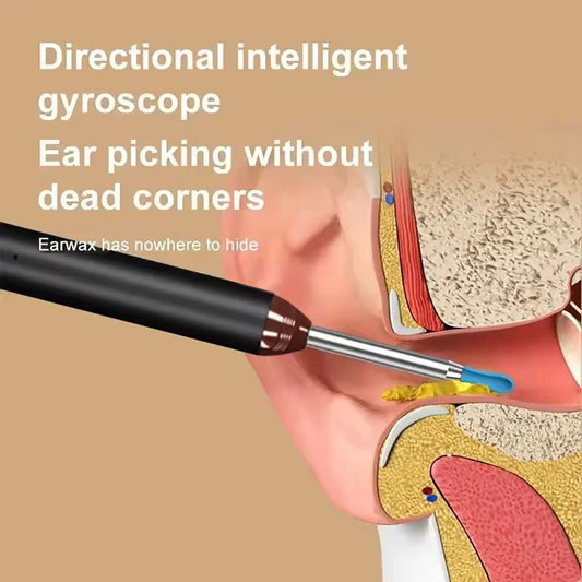 Earwax Removal Tool Kit with HD Camera Wifi Connection & LED Lights Endoscope Tool Ear Cleaner for iOS & Android